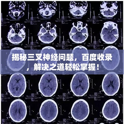 揭秘三叉神经问题，百度收录，解决之道轻松掌握！