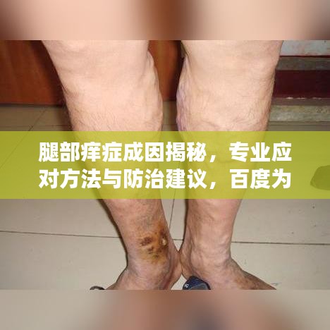 腿部痒症成因揭秘，专业应对方法与防治建议，百度为您解答！